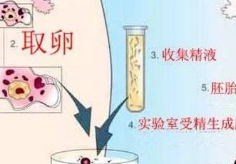 2026年比较好的医院三代试管婴儿医院靠谱吗？