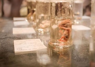 hiv患者去马来西亚马六甲医院做一次试管能成功吗？需要花费多少钱啊