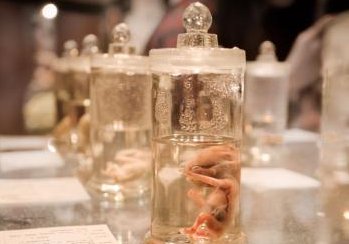 沈阳市第三代试管婴儿全程费用大揭秘，费用构成清晰明了，让您消费心中有数