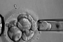 哪个国家的试管婴儿的成功率性价比高？附部分国家名单